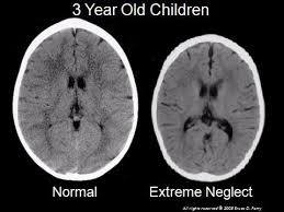 creier copii abuzati